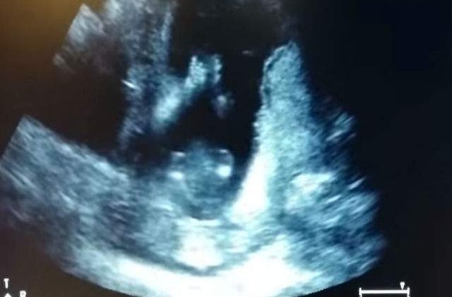 [VIDEO] Un bebelus bate din palme in pantece in timp ce mama sa ii canta