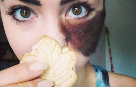 I-au spus sa isi opereze semnul din nastere, dar il poarta cu mandrie