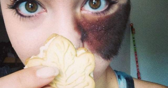 I-au spus sa isi opereze semnul din nastere, dar il poarta cu mandrie