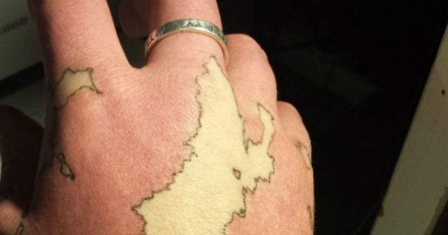 Si-a transformat semnul din nastere in harta unui tinut imaginar