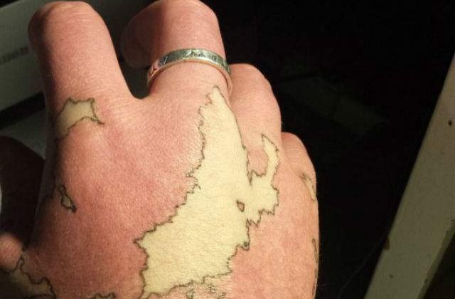 [FOTO] Si-a transformat semnul din nastere in harta unui tinut imaginar