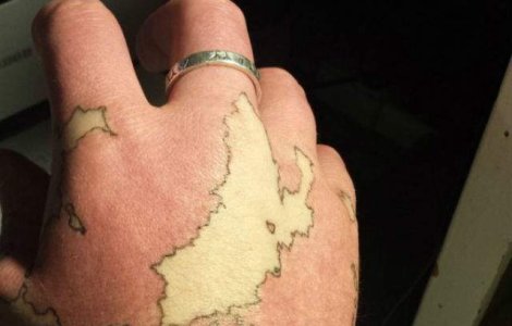 Si-a transformat semnul din nastere in harta unui tinut imaginar