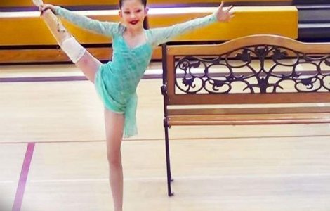  Video  Are un picior amputat, dar danseaza exceptional