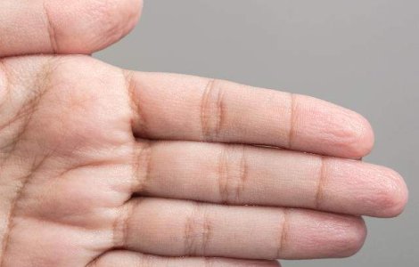  Video  De ce ni se incretesc degetele in apa