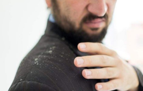  Top  Ti-a facut viata un calvar? 8 trucuri pentru a SCAPA de matreata