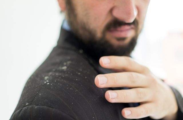 Ti-a facut viata un calvar? 8 trucuri simple pentru a SCAPA de matreata