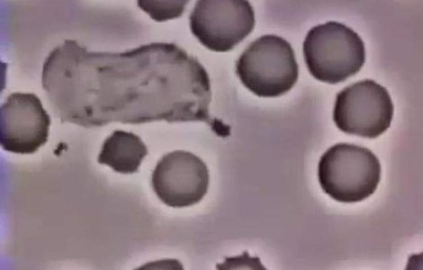 Studiu: Modificari genetice minore au transformat bacteria Mortii Negre intr-un ucigas in serie