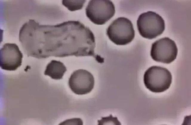 Studiu: Modificari genetice minore au transformat bacteria Mortii Negre intr-un ucigas in serie