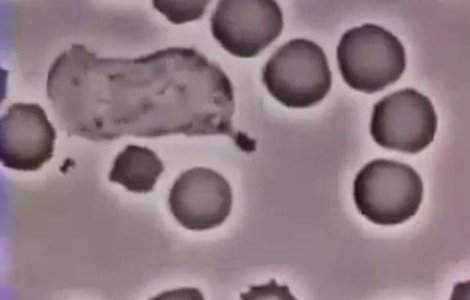 Studiu: Modificari genetice minore au transformat bacteria Mortii Negre intr-un ucigas in serie