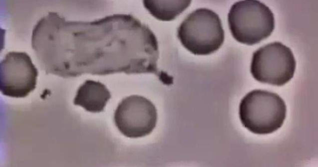 Studiu: Modificari genetice minore au transformat bacteria Mortii Negre intr-un ucigas in serie