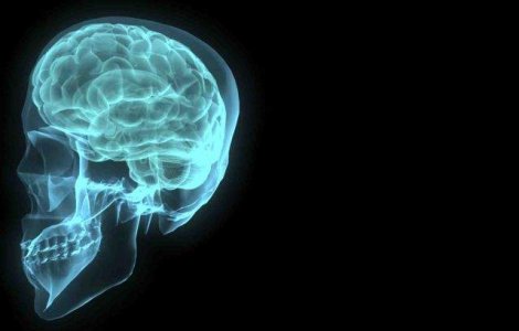 SNR: Peste 80% dintre pacientii cu tulburare cognitiva usoara dezvolta dementa pe parcursul vietii