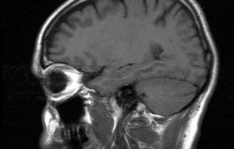 Reabilitarea bolnavului cu probleme neurocognitive: prin muzica, mirosuri, privit in oglinda