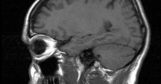 Reabilitarea bolnavului cu probleme neurocognitive: prin muzica, mirosuri, privit in oglinda