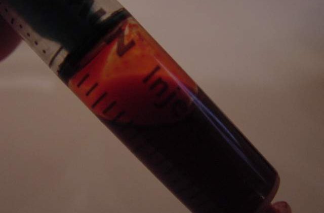 La ce BOLI esti predispus? Influenta GRUPEI SANGUINE asupra starii de sanatate