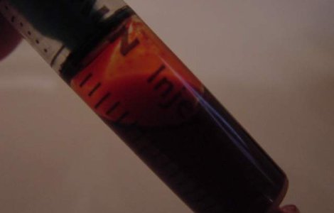  Top  La ce BOLI esti predispus? Influenta GRUPEI SANGUINE asupra sanatatii