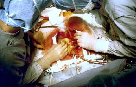  Video  Uimitor! Cum arata interiorul unei inimi care bate