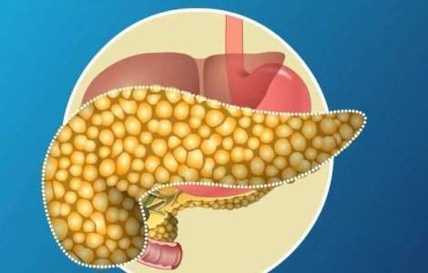  Top  Ai probleme cu pancreasul? Ce TREBUIE sa mananci pentru a nu ajunge la spital