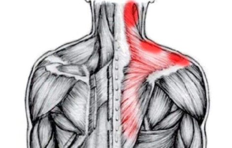  Top  Se poate si fara pastile! Cum scapi de DURERE cu ajutorul alimentelor