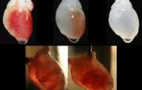 Inima viitorului, speranta pentru oameni