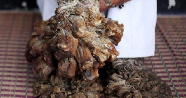  Top  Incredibil, dar adevarat! Cele mai BIZARE boli din istoria omenirii