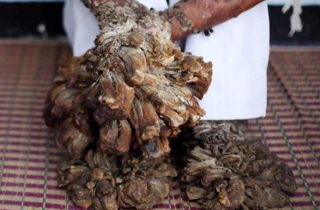 Incredibil, dar adevarat! Cele mai BIZARE boli din istoria omenirii