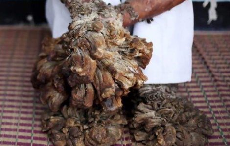  Top  Incredibil, dar adevarat! Cele mai BIZARE boli din istoria omenirii