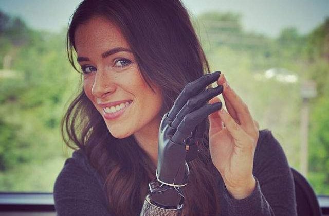 [FOTO] Rebekah Marine, modelul cu brat bionic care va defila la Saptamana Modei de la New York