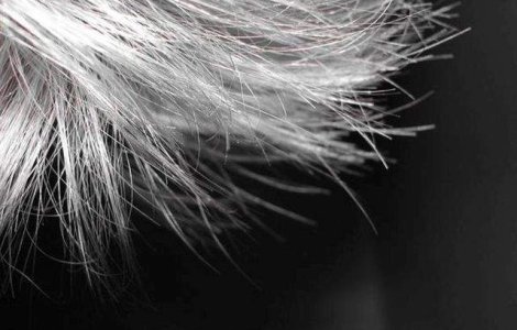  Top  Ce PROBLEME de sanatate poate indica fragilitatea parului tau