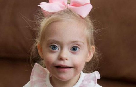  Video  Are sindromul Down, dar la 2 ani a primit primul contract de modeling