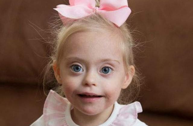 [VIDEO] Are sindromul Down, dar la 2 ani a primit primul contract de modeling