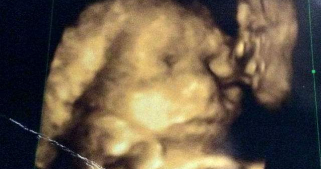 A mers la ecografie. Ce a vazut, a lasat-o fara cuvinte