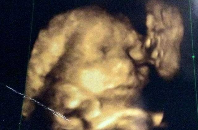 [VIDEO] A mers la ecografie. Ce a vazut, a lasat-o fara cuvinte