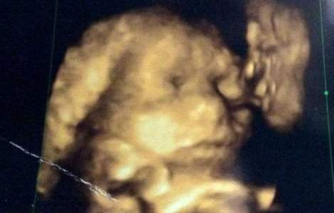  Video  A mers la ecografie. Ce a vazut, a lasat-o fara cuvinte