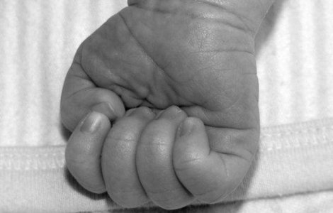 Copil de 16 luni, operat cu succes, dupa un caz rar de "decapitare interna"