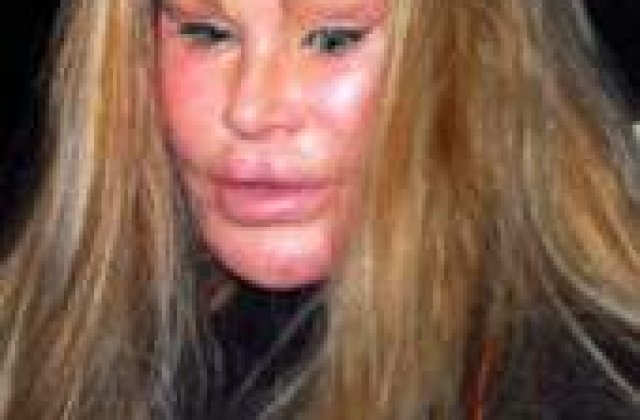 A cheltuit milioane de dolari ca sa se desfigureze