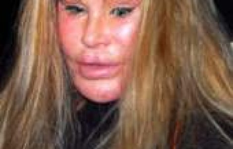 A cheltuit milioane de dolari ca sa se desfigureze