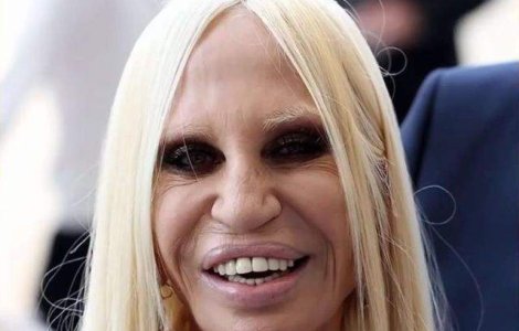  Top  Mutilati pe viata! Cele mai nereusite operatii estetice