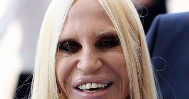  Top  Mutilati pe viata! Cele mai nereusite operatii estetice