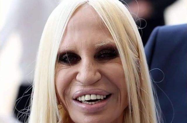 Mutilati pe viata! Cele mai nereusite operatii estetice