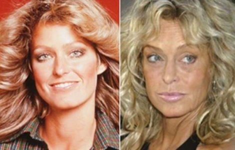  Top  Timpul nu iarta pe nimeni! Celebritati care au imbatranit urat