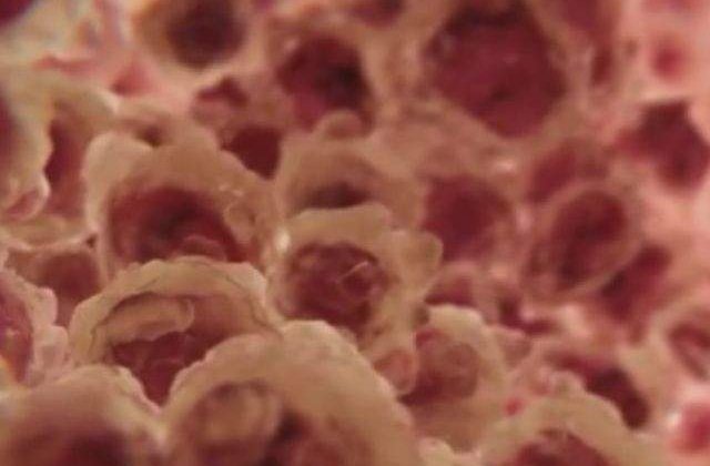 Si plantele pot avea cancer! Tot ce nu stiai despre cumplita boala