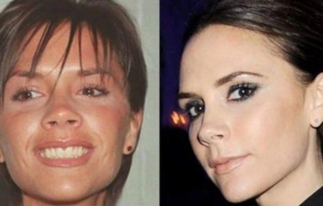  Top  Adevarata fata a vedetelor! Cum aratau inainte de operatii estetice