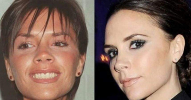 Top  Adevarata fata a vedetelor! Cum aratau inainte de operatii estetice