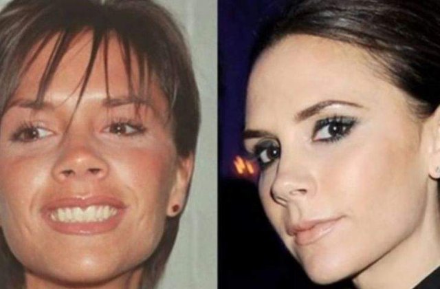 Adevarata fata a vedetelor! Cum aratau inainte de operatii estetice