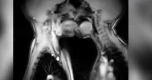 Cum arata o partida de sex vazuta la RMN