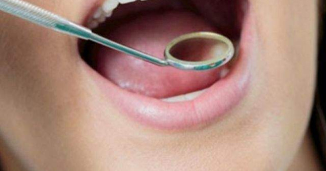  Top  Ce boli riscam daca nu tratam afectiunile dentare