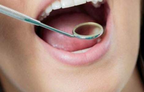  Top  Ce boli riscam daca nu tratam afectiunile dentare