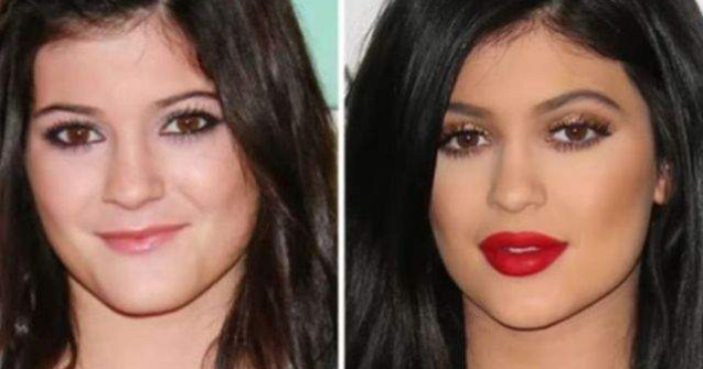  Top  Adevarata fata a vedetelor! Cum aratau celebritatile inainte de operatii estetice