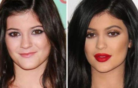 Top  Adevarata fata a vedetelor! Cum aratau celebritatile inainte de operatii estetice