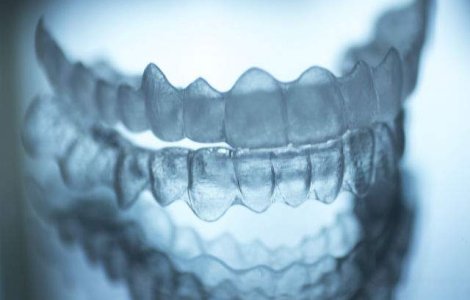 Un student si-a printat un aparat dentar 3D. A costat doar 60 dolari